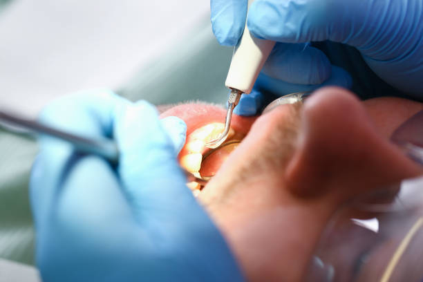 Best Emergency Treatment for Oral Infections in Lake Pocotopaug, CT